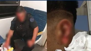 Fotos: a lo Tyson, le arrancó un pedazo de oreja a un policía a mordiscones