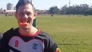 Sufrió una grave lesión cervical jugando al rugby y piden ayuda para costear su recuperación