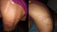 Una madre castigó a su hijo de 7 años con una caña: "Capaz me pasé y le pegué un poquito de más” 