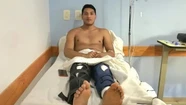 Un joven fue a hacerse una cirugía en la rodilla, despertó y le habían operado las dos piernas