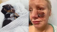 Kelly Allen perdió parte de su mejilla y quedó traumada