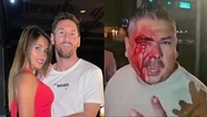Un hombre fue brutalmente golpeado tras intentar sacarle una foto a Lionel Messi y a Antonela Roccuzzo 