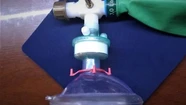 Desarrollan un dispositivo no invasivo para postergar el uso del respirador en pacientes Covid